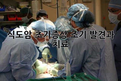 식도암 초기증상: 조기 발견과 치료